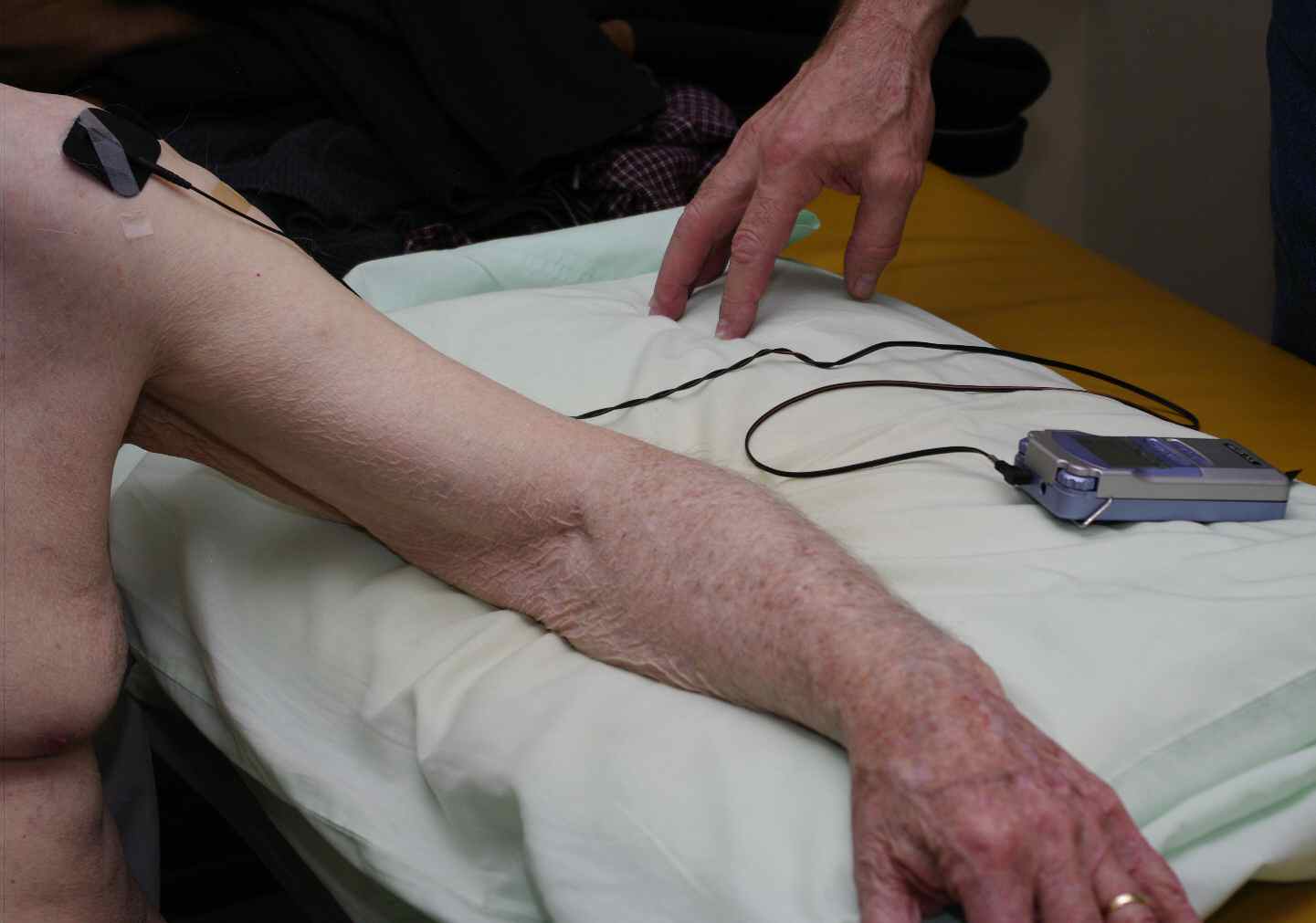 Electrical stimulation applied to shoulder